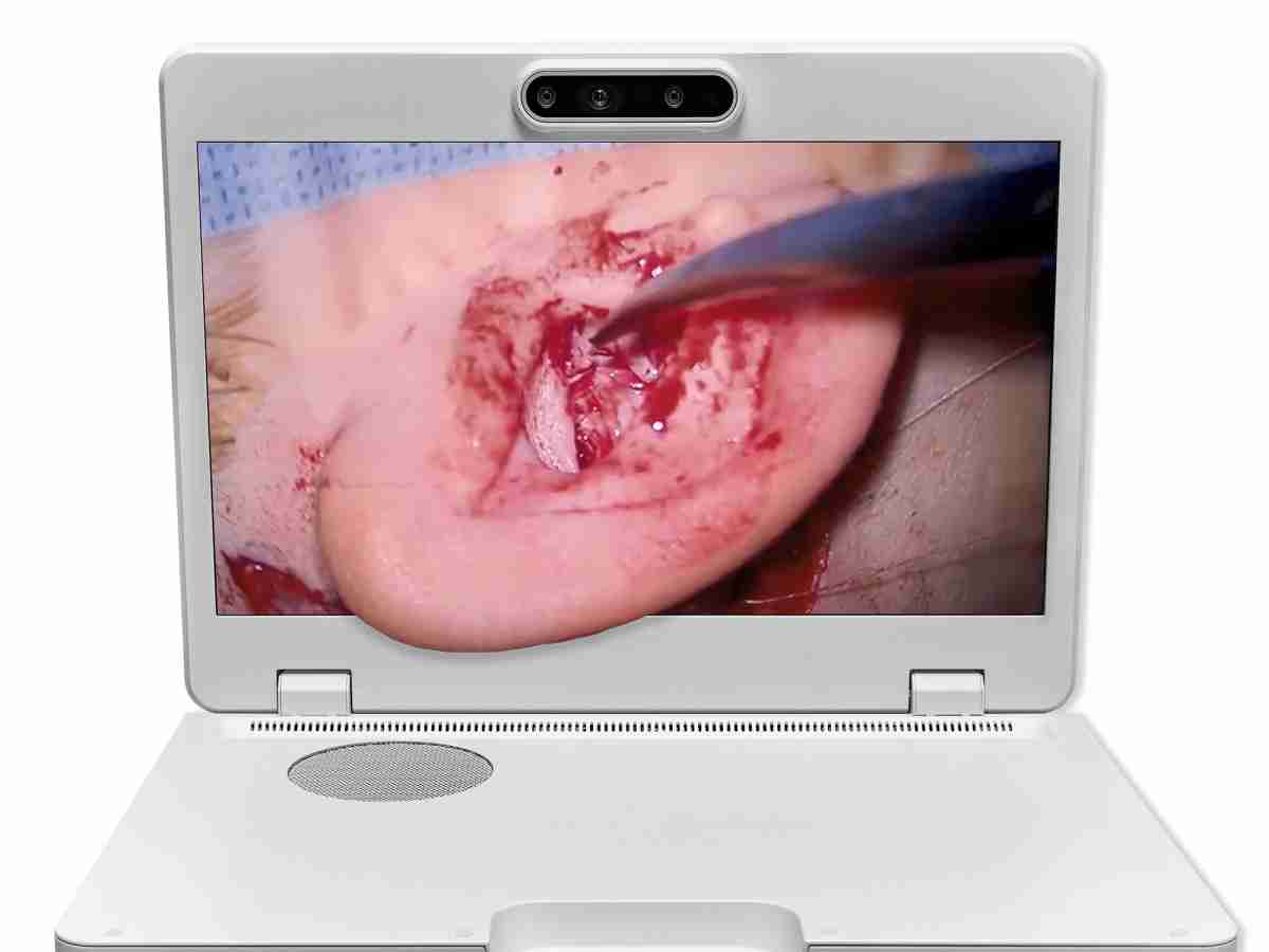 达擎之＂Heads-up 3D显微手术显示系统＂，，，，整合4K裸眼3D显示及眼球追踪系统，，，，具备快速追踪人眼移动位置功能，，，减轻医师长时间维持固定姿势的负担，，，，让医师能有更宽广清晰的3D立体视野及更舒适的姿势来执行手术。。